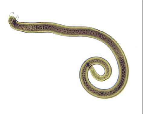 Trichinella spiralis