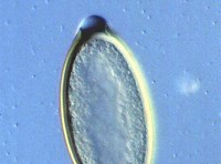 Trichuris muris